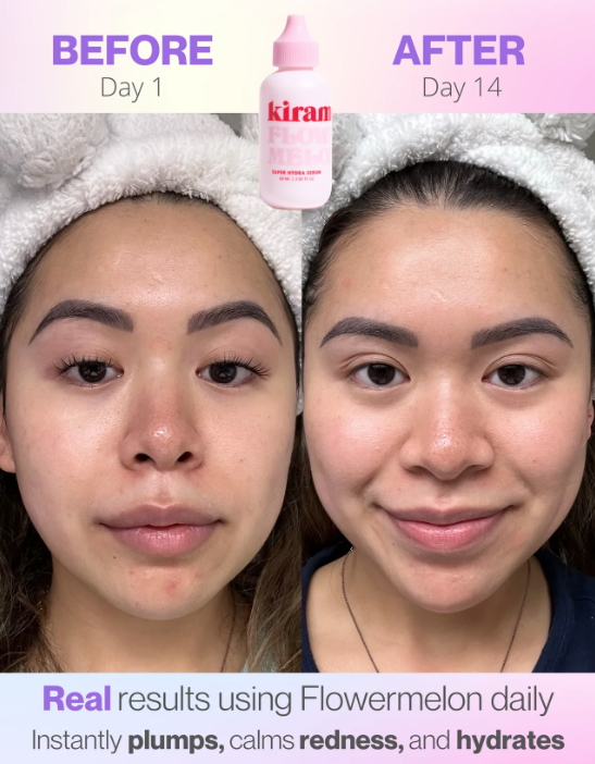 FLOWER MELON SUPER HYDRA SERUM - KIRAMOON